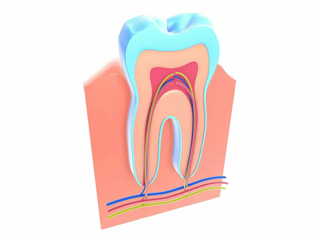 root canal treatment